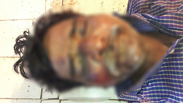 ಕಲ್ಲಿನಿಂದ ಥಳಿಸಿ ವ್ಯಕ್ತಿಯ ಹತ್ಯೆ: ಆರೋಪಿ ಬಂಧನ